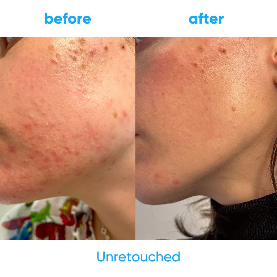 Nettoyant visage 100 % naturel - Sans parfum